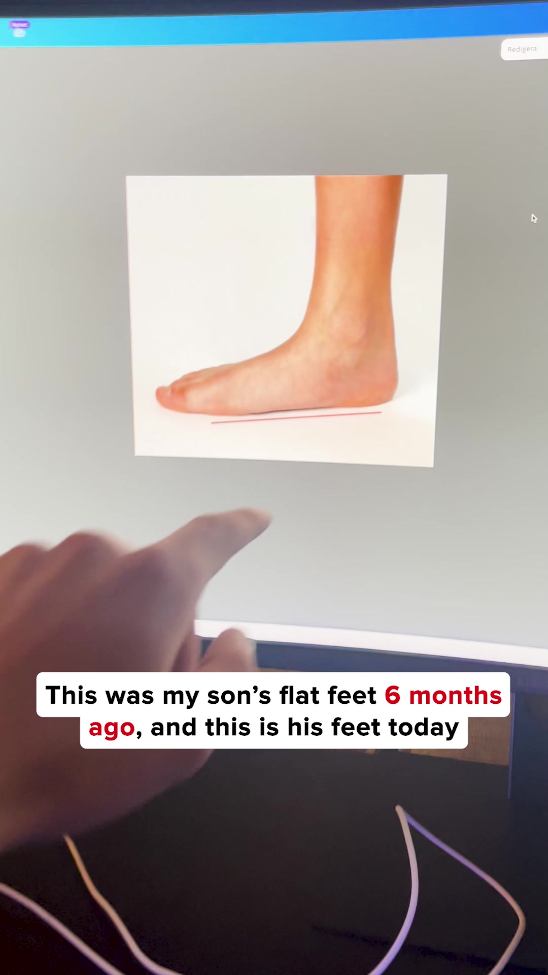 Foot Alignment Journal