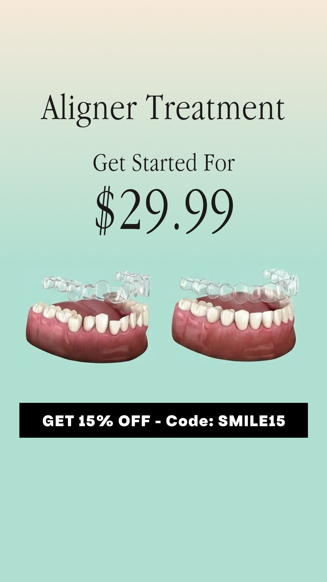 SmileSet