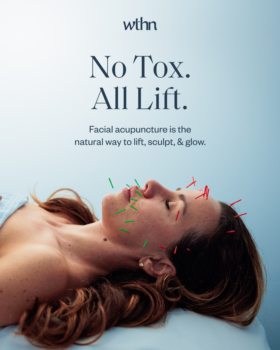 WTHN Acupuncture