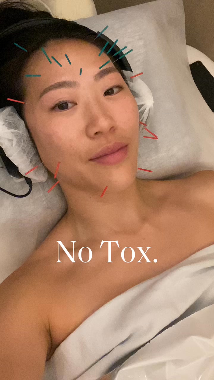 WTHN Acupuncture