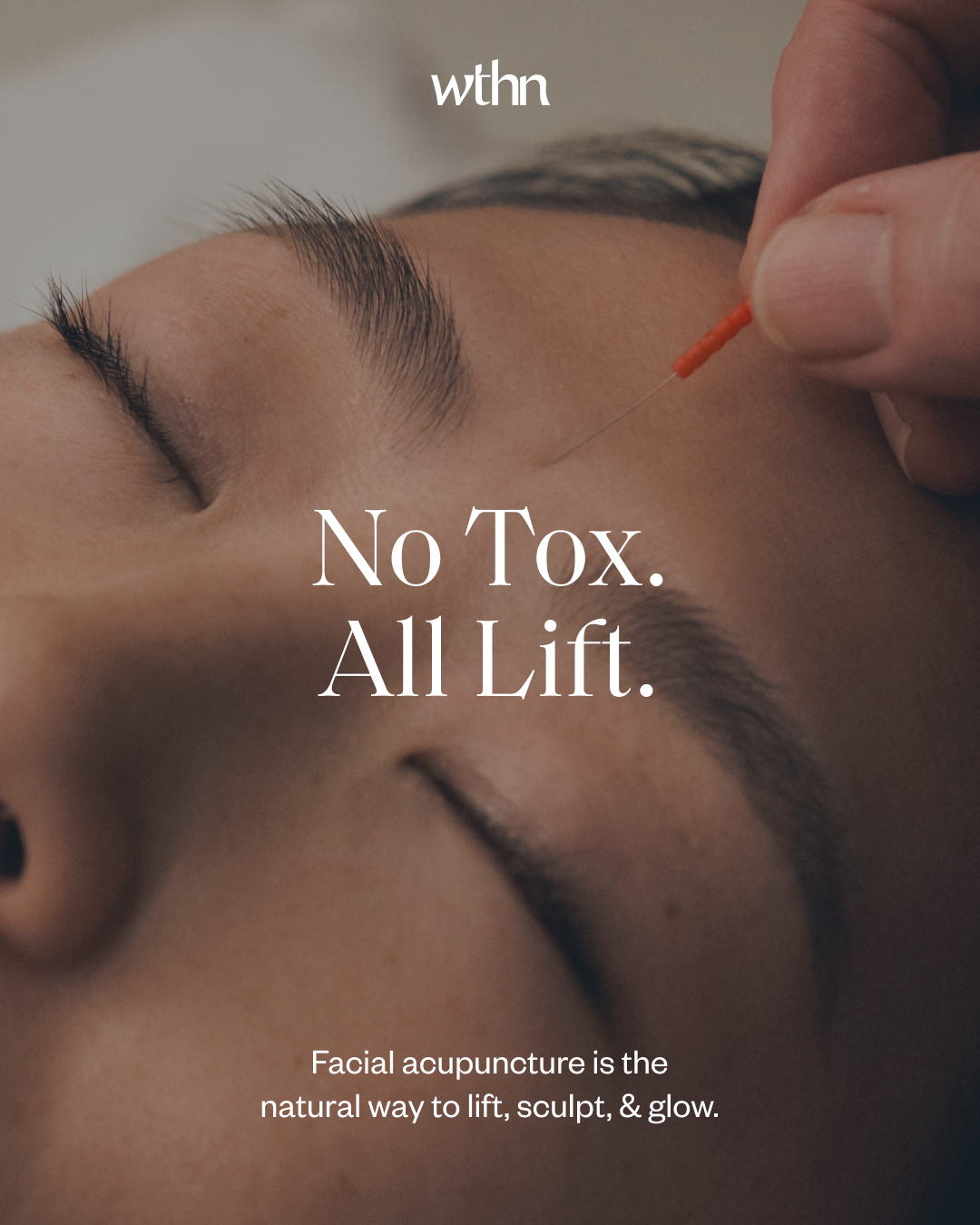 WTHN Acupuncture